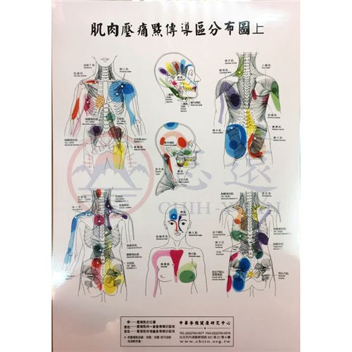 肌肉壓痛點傳導區分布套圖(一套3張)