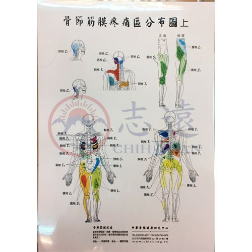 骨節筋膜疼痛區分布圖(一套2張)